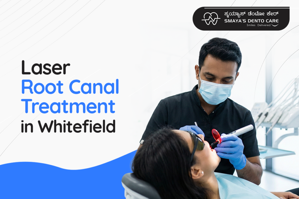 Laser Root Canal Treatment in Whitefield