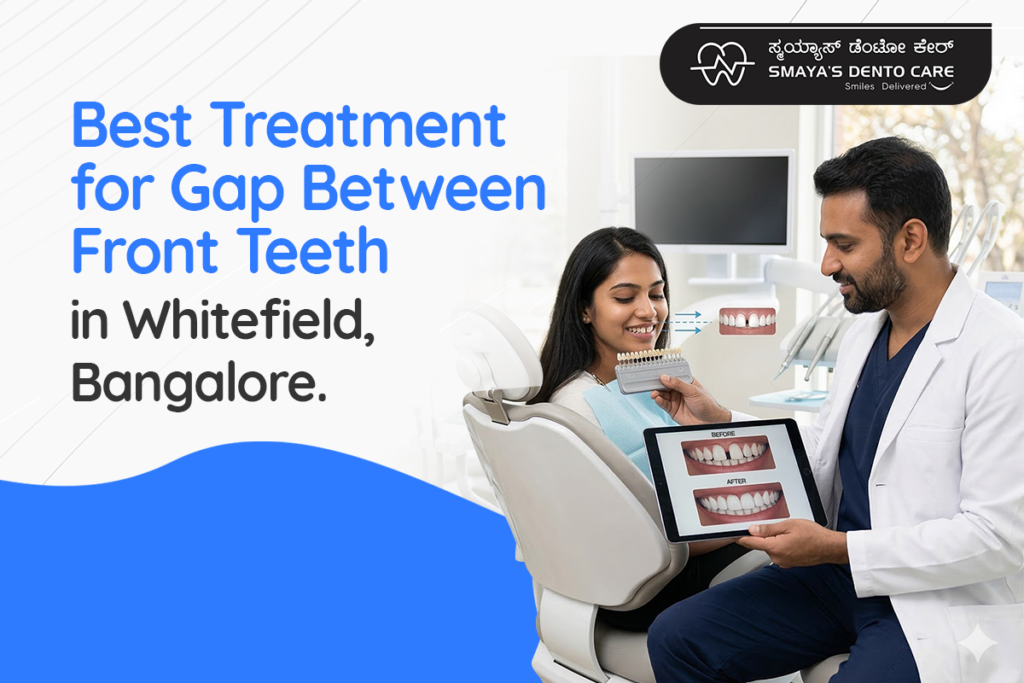 Front teeth gap correction Whitefield, Bangalore