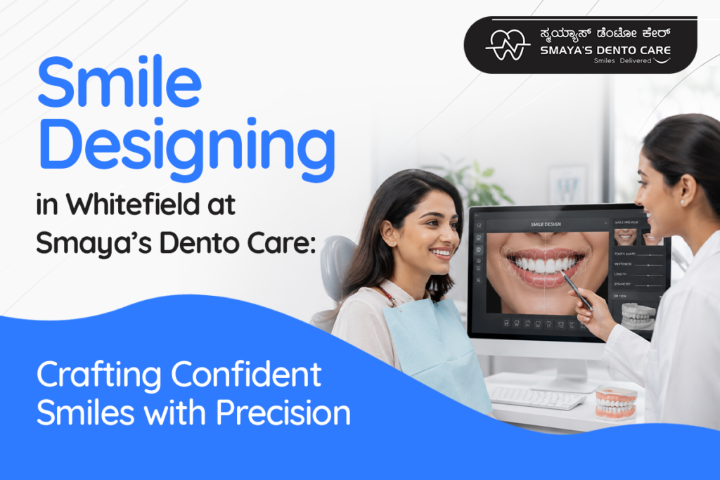 Smile Designing in Whitefield