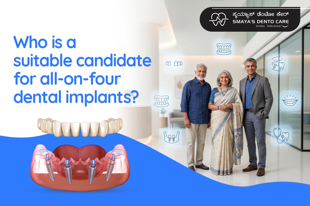 All-on-4 Dental Implants