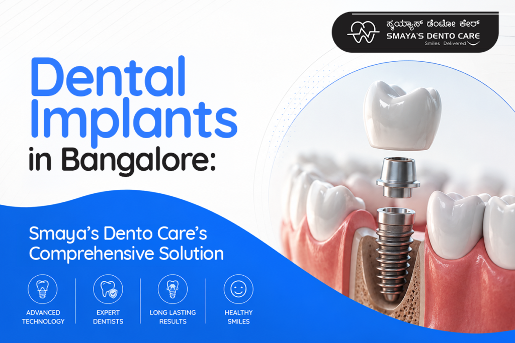 Dental Implants in Bangalore