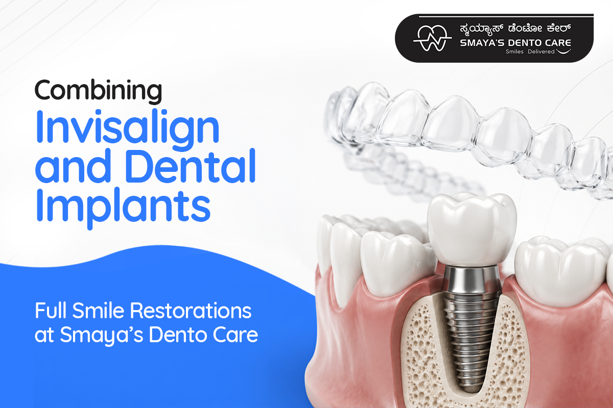 Invisalign and dental implants