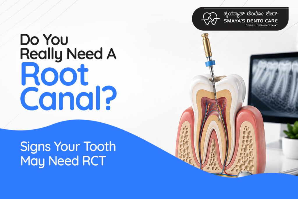 root canal treatment In Bangalore