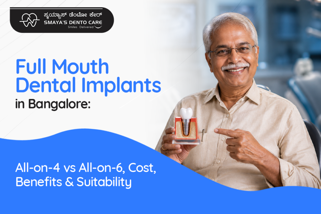 Full Mouth Dental Implants in Bangalore
