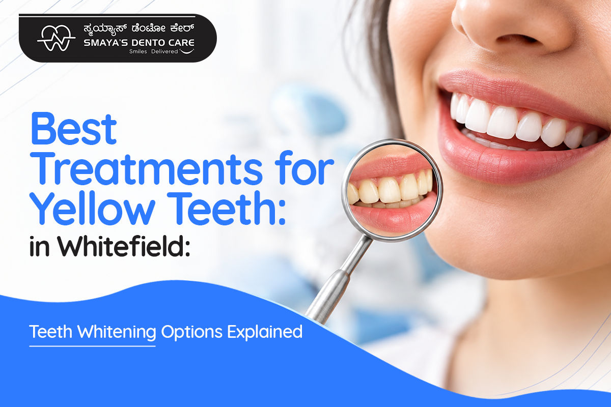 Teeth Whitening Treatment in Bangalore