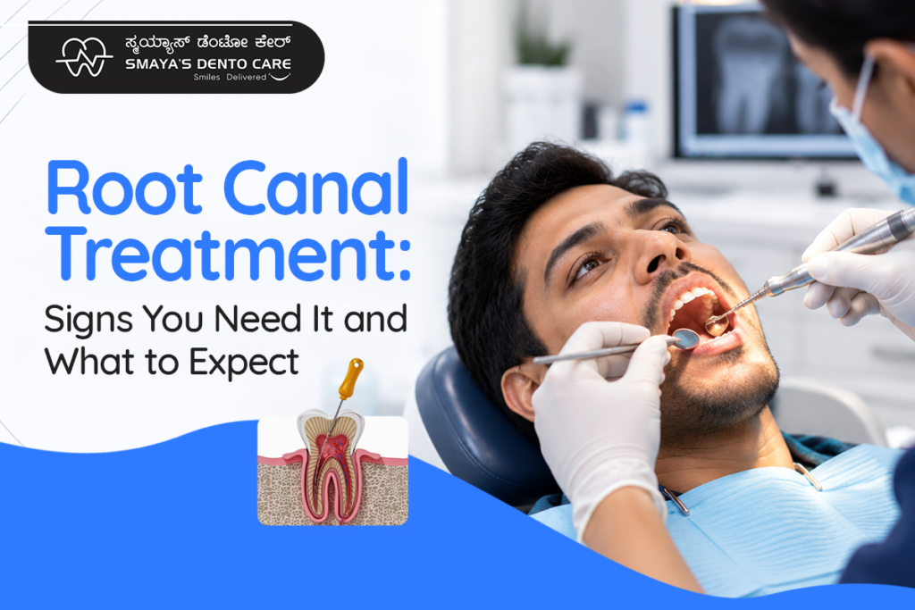 Root Canal Treatment bangalore