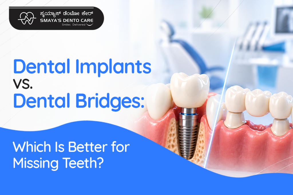 Dental implants vs dental bridges
